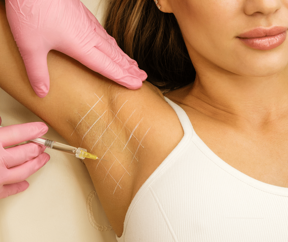 miraDry vs Botox for Underarm Sweating