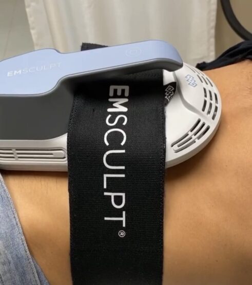 The Perfect You EMSCULPT